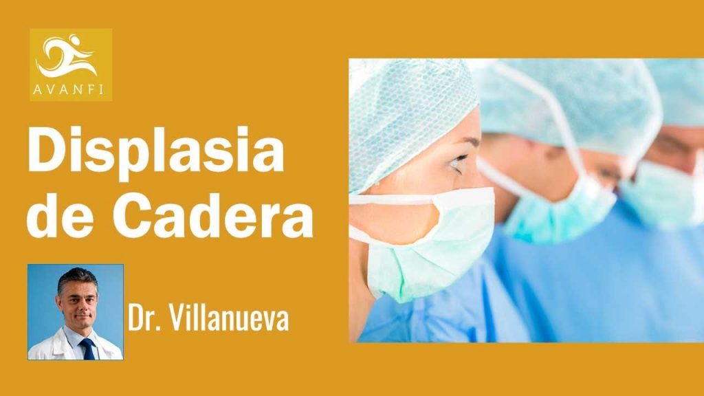 Que es la displasia de cadera