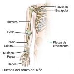 Dolor de brazos y manos