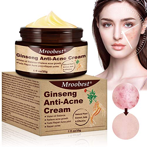 Crema anti granos